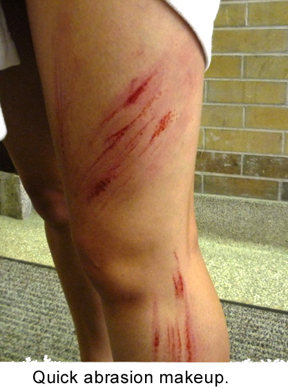 Abrasion Abrasion